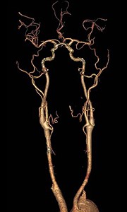 Giới thiệu Khoa Chẩn Đoán Hình Ảnh