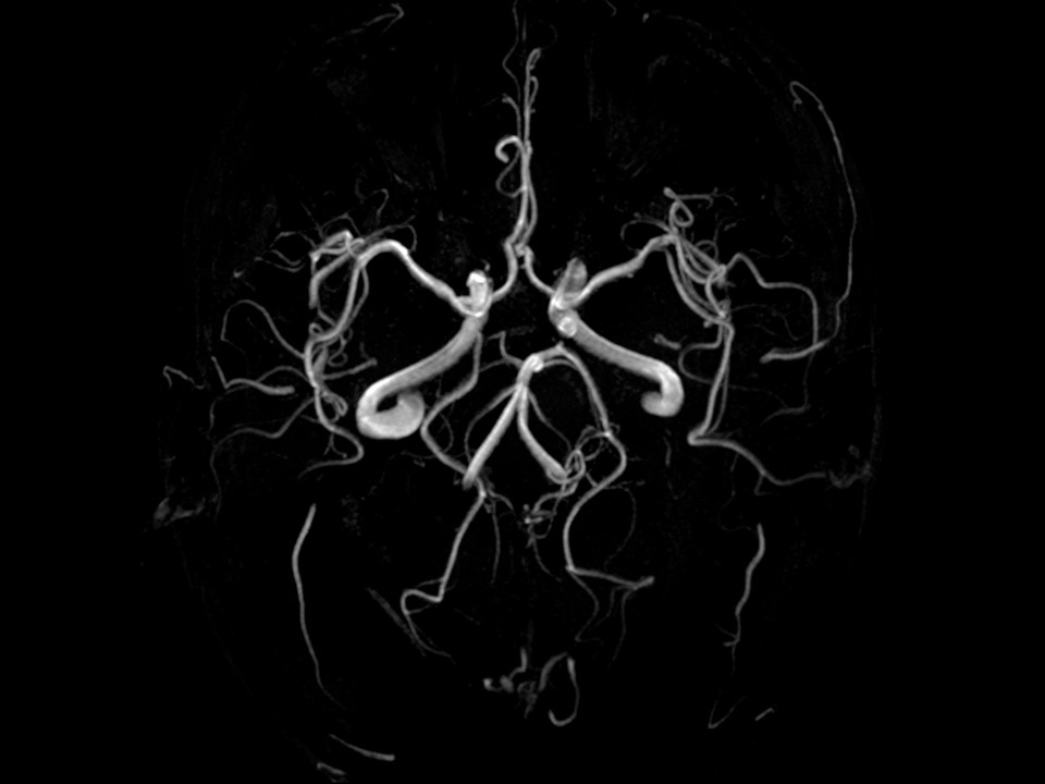 Giới thiệu Khoa Chẩn Đoán Hình Ảnh