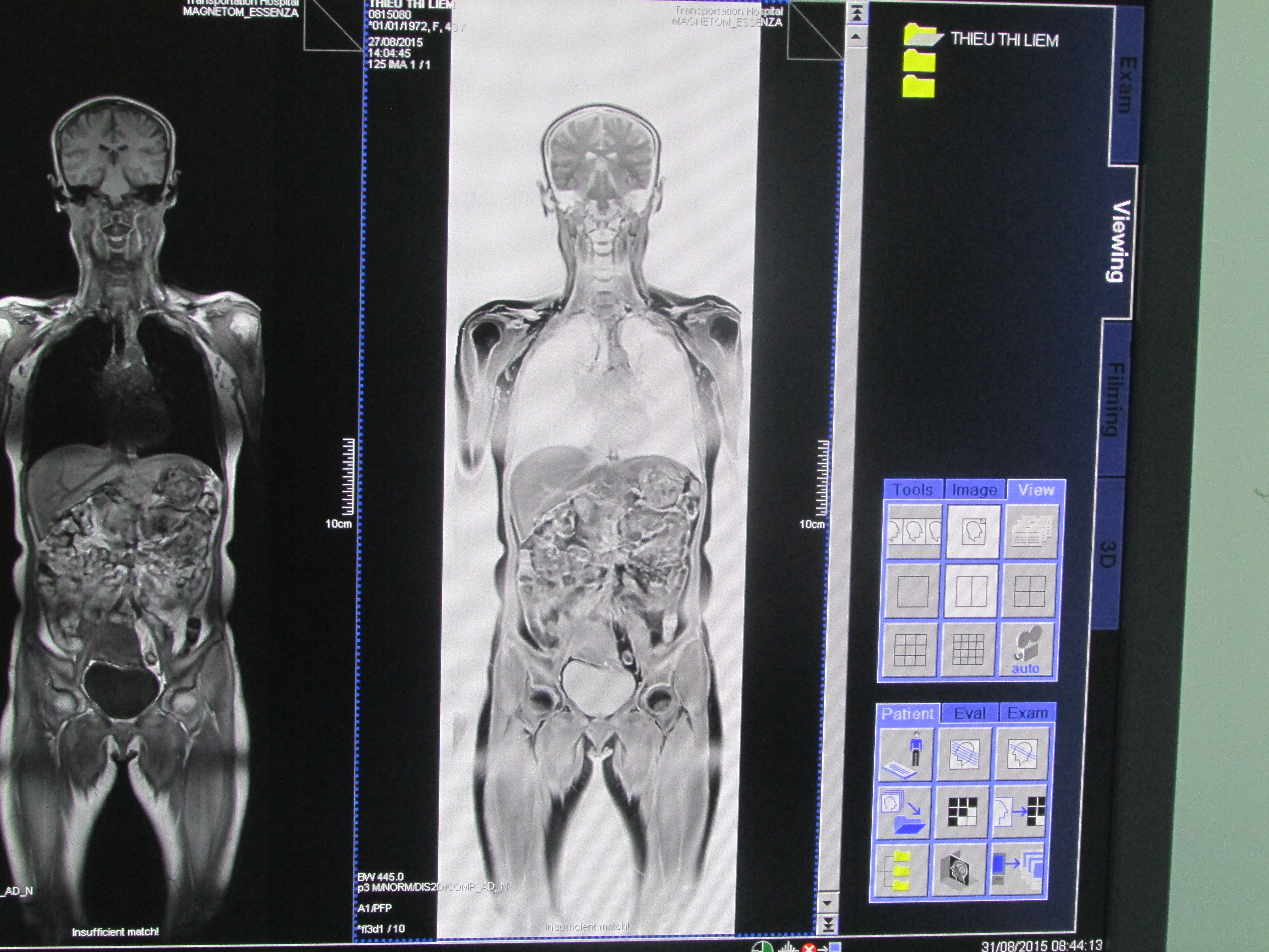 Giới thiệu Khoa Chẩn Đoán Hình Ảnh