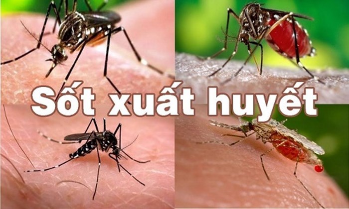 Thông tin về bệnh an điều dưỡng sốt xuất huyết dengue bạn cần biết