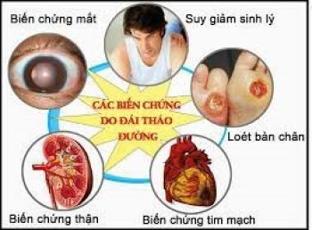 NHỮNG ĐIỀU CẦN BIẾT VỀ BỆNH TIỂU ĐƯỜNG