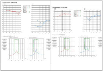 CA LÂM SÀNG ĐIẾC ĐỘT NGỘT TẠI KHOA TAI MŨI HỌNG – BỆNH VIỆN GIAO THÔNG VẬN TẢI