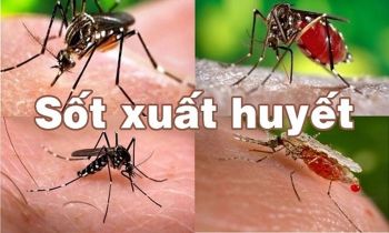 CHẨN ĐOÁN VÀ ĐIỀU TRỊ  SỐT XUẤT HUYẾT DENGUE NGƯỜI LỚN